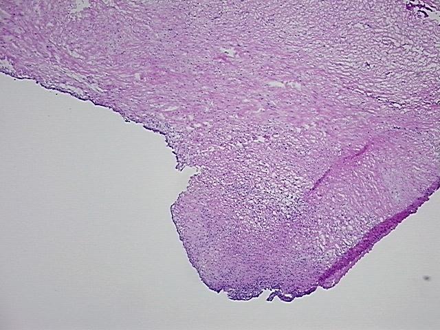 4x Image