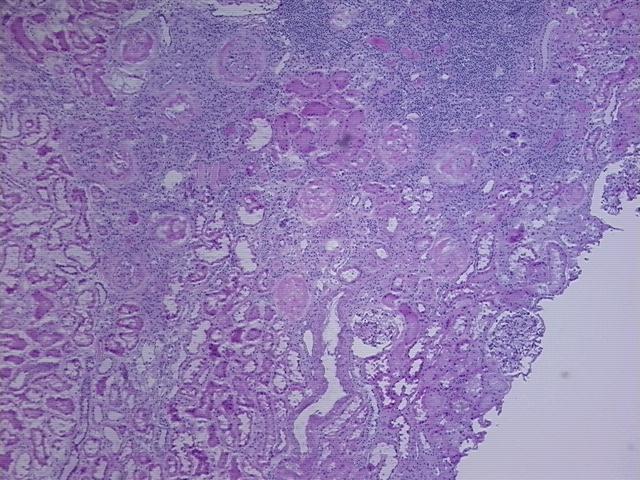 4x Image