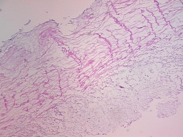 4x Image