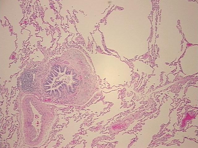 4x Image
