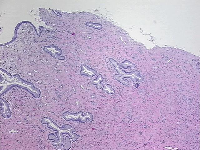 4x Image
