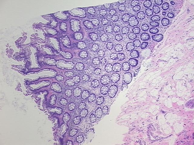 4x Image