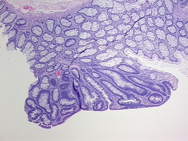 4x Image