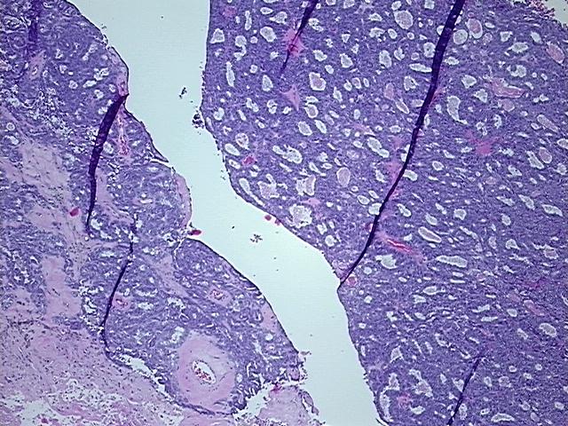 4x Image