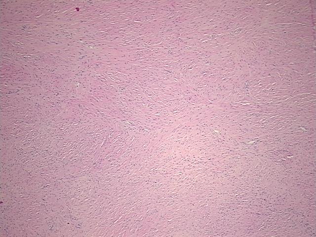 4x Image