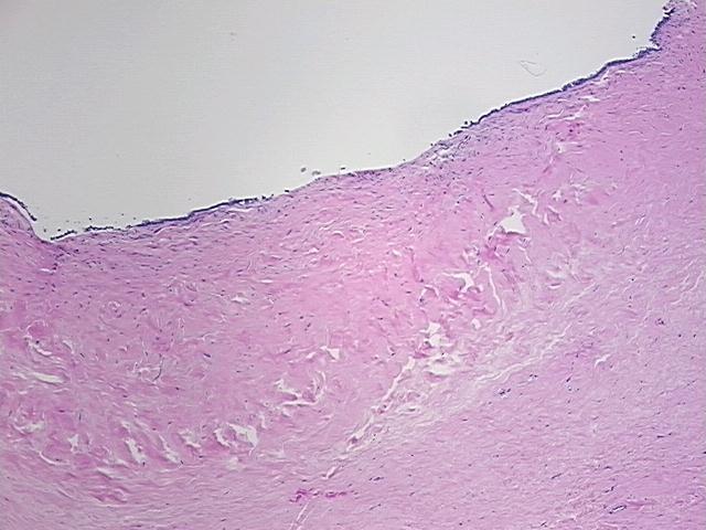 4x Image