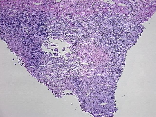4x Image