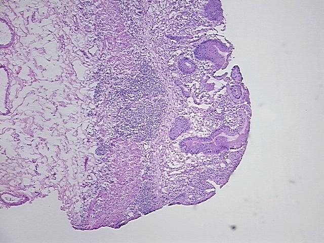 4x Image