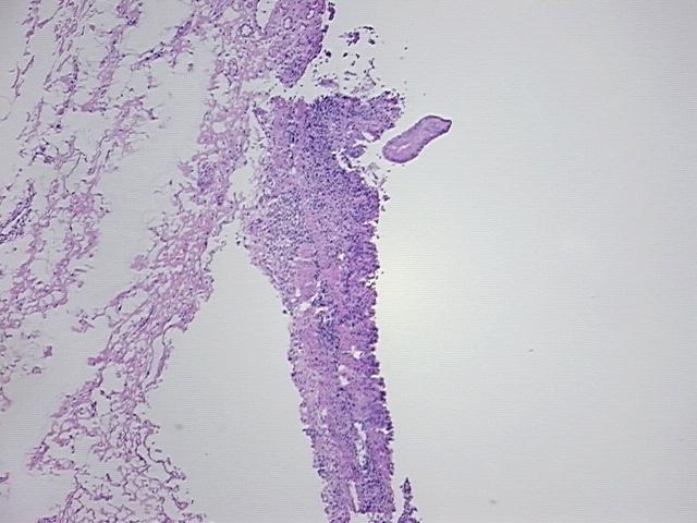 4x Image