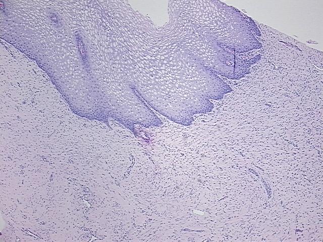 4x Image