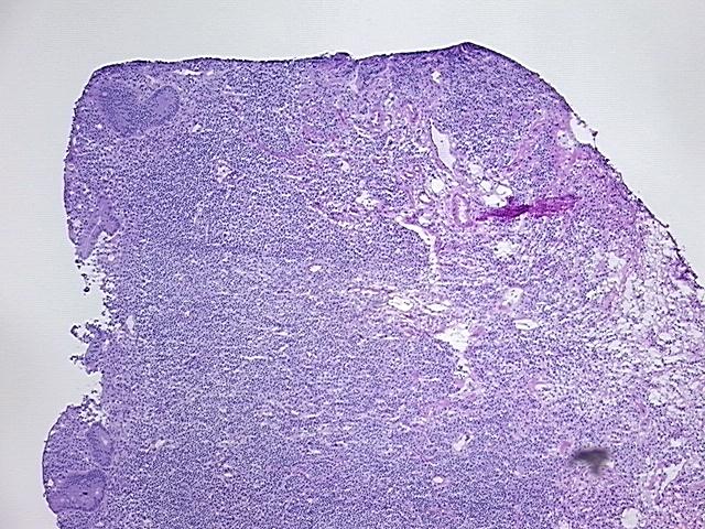 4x Image