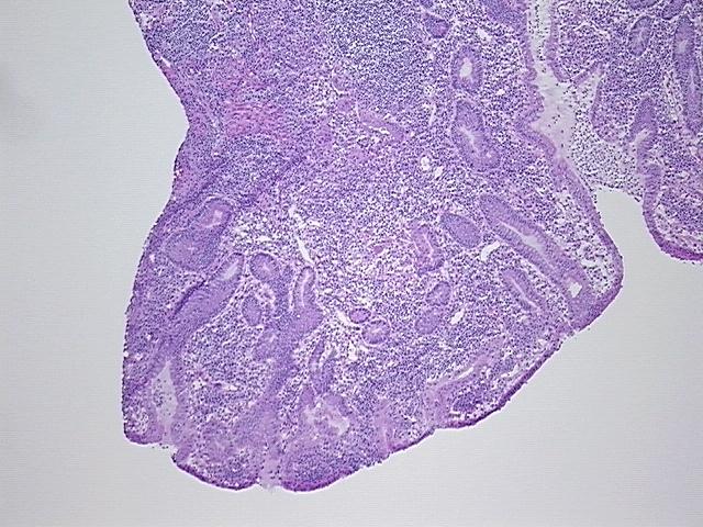4x Image