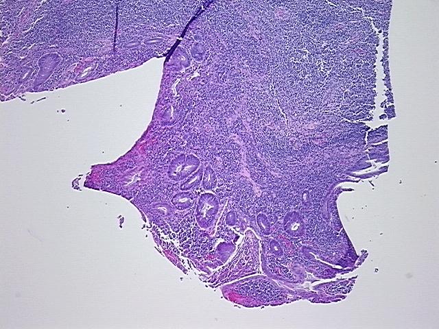4x Image