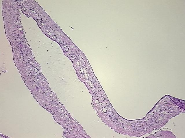 4x Image