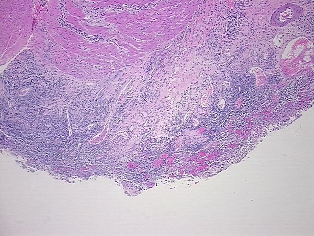 4x Image