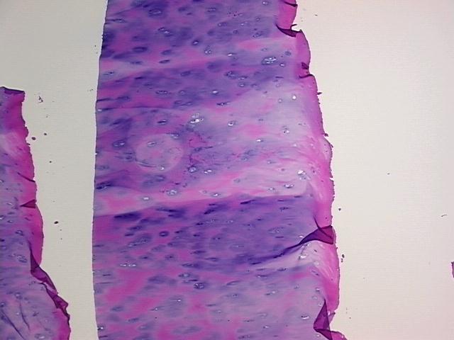 4x Image