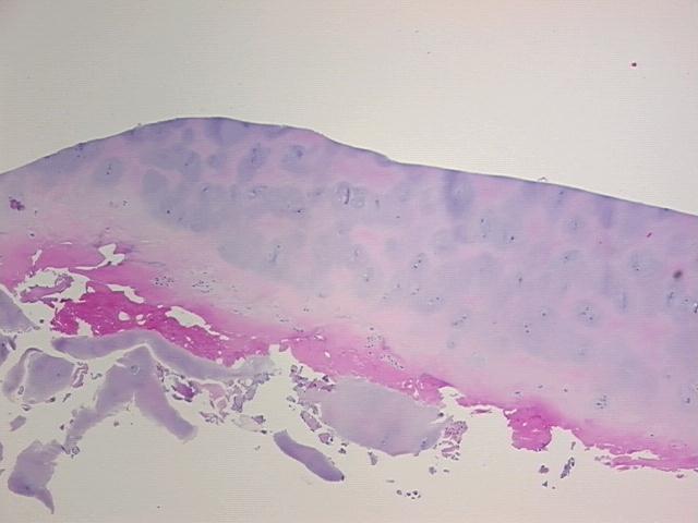 4x Image