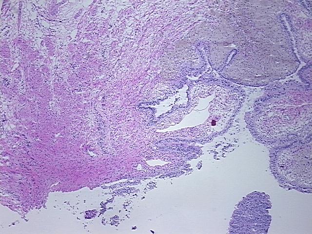 4x Image