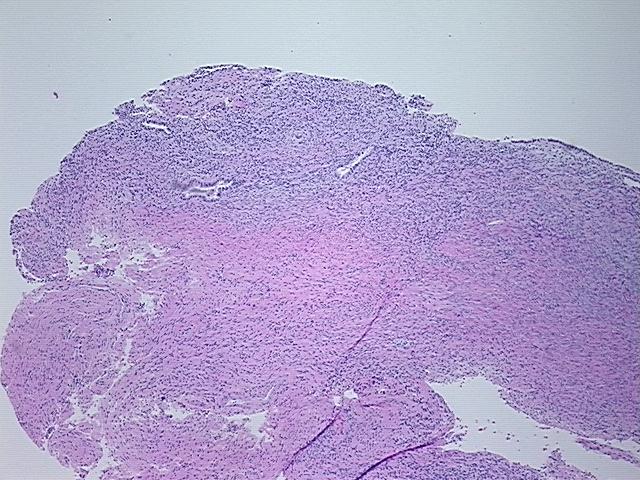 4x Image