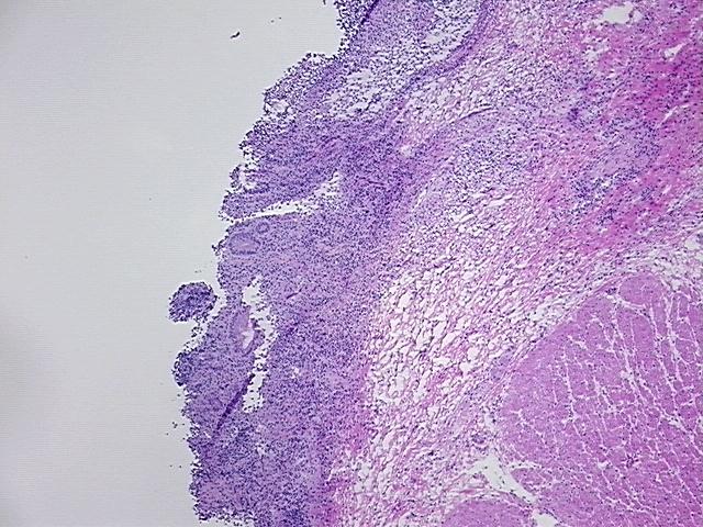 4x Image