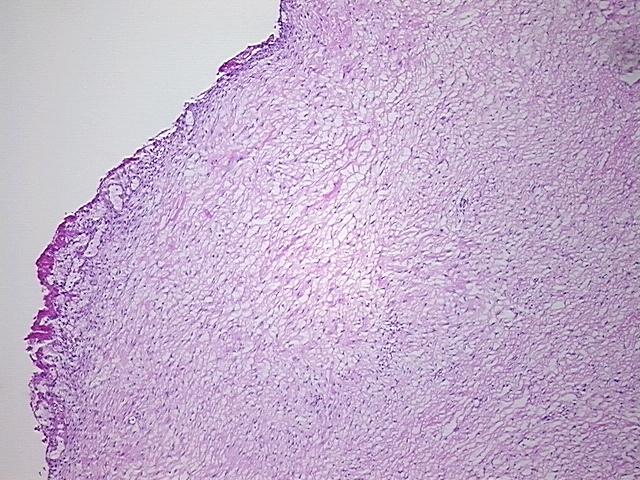 4x Image