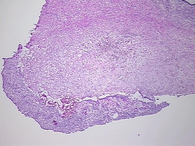 4x Image