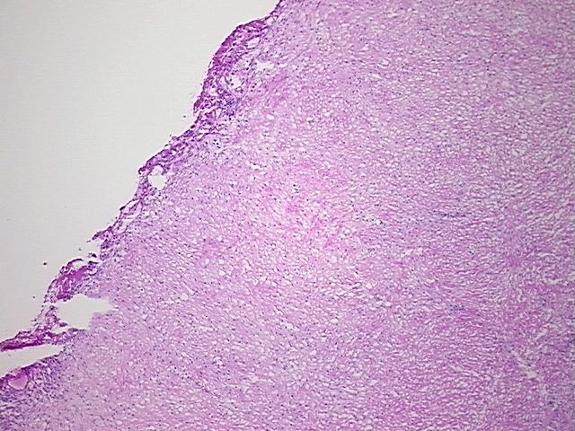 4x Image
