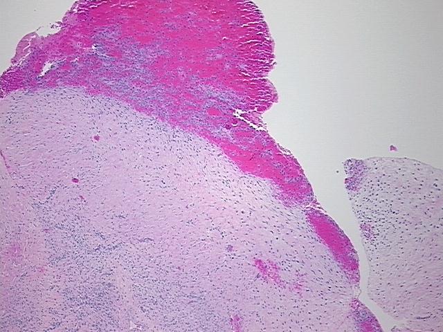 4x Image