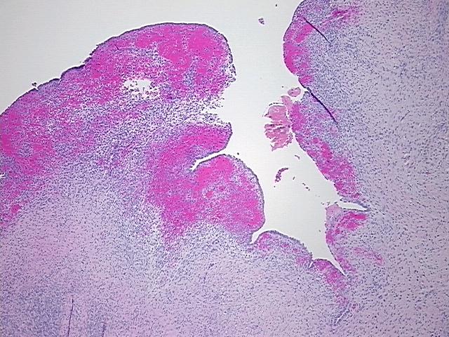 4x Image