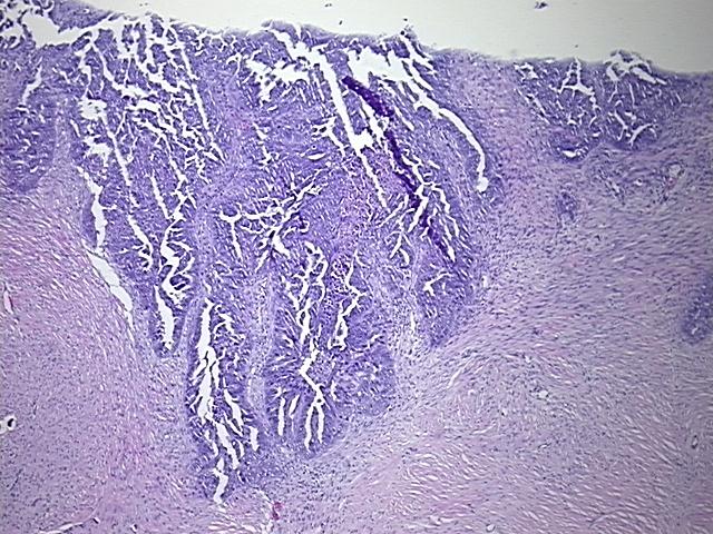 4x Image