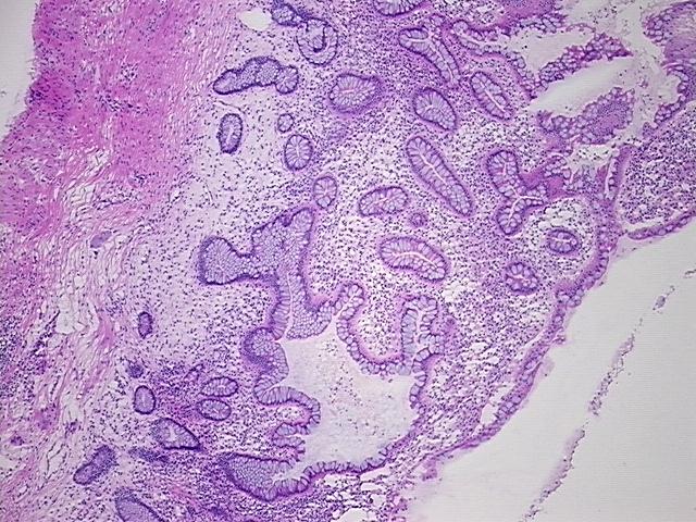 4x Image
