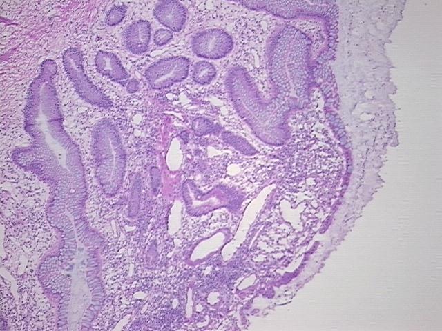 4x Image