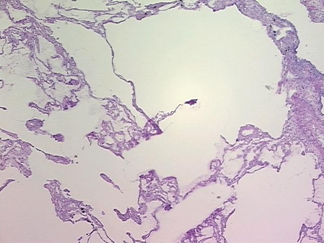 4x Image