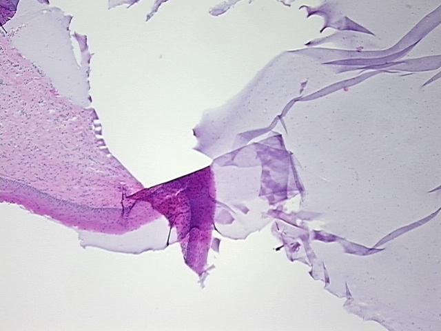 4x Image