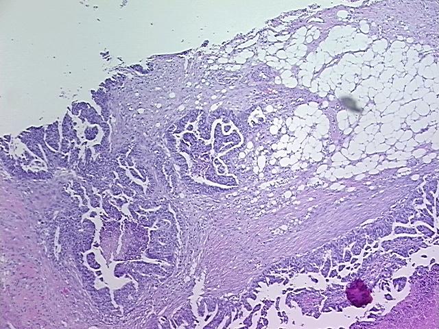 4x Image