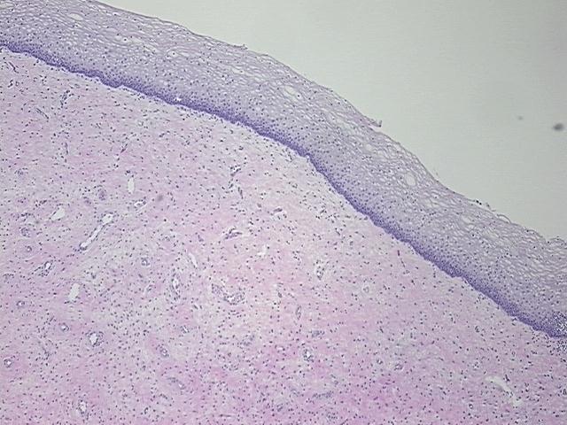 4x Image