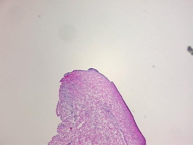 4x Image