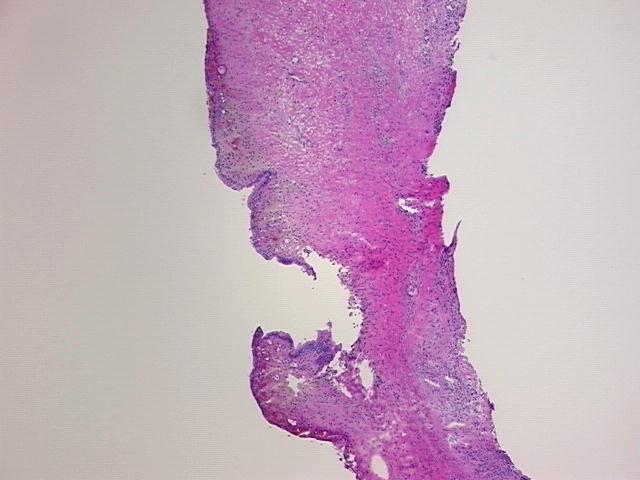 4x Image