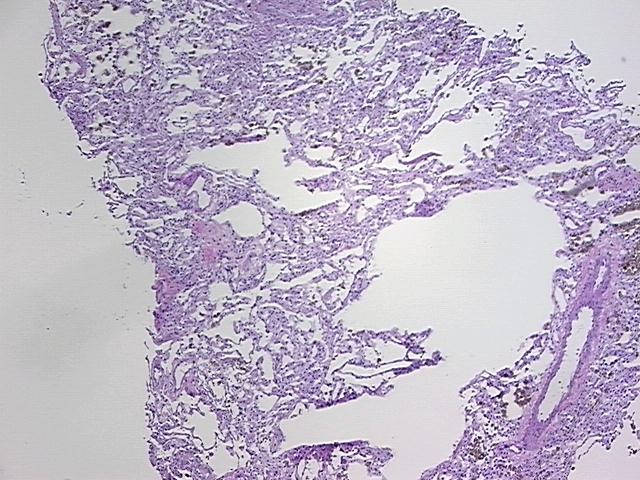 4x Image