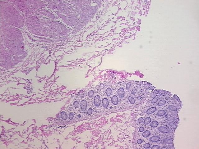 4x Image