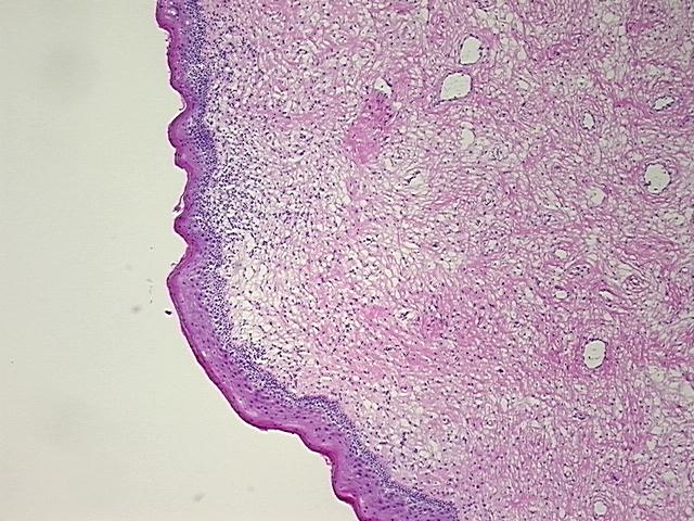4x Image