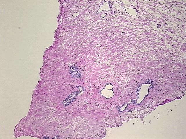 4x Image