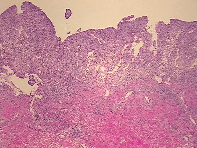 4x Image