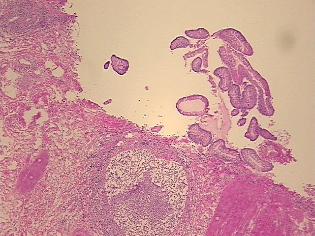 4x Image