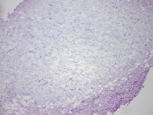 4x Image