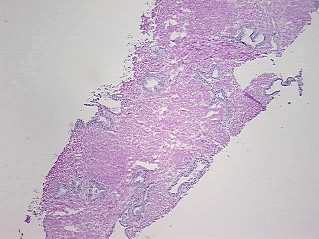 4x Image
