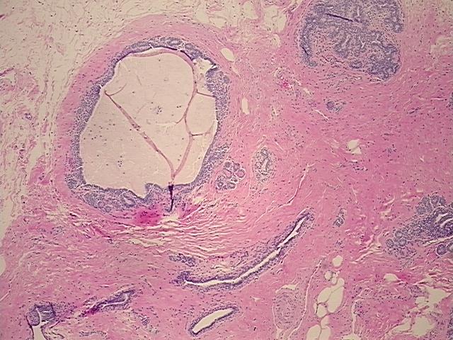 4x Image