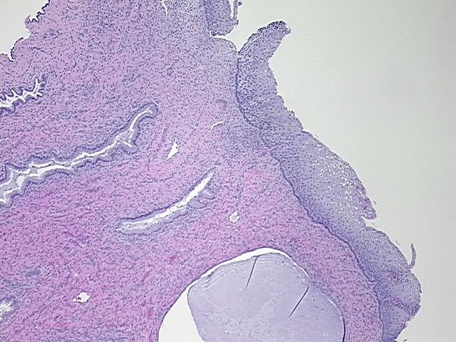 4x Image
