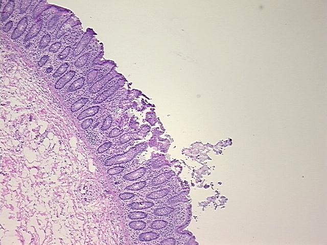 4x Image