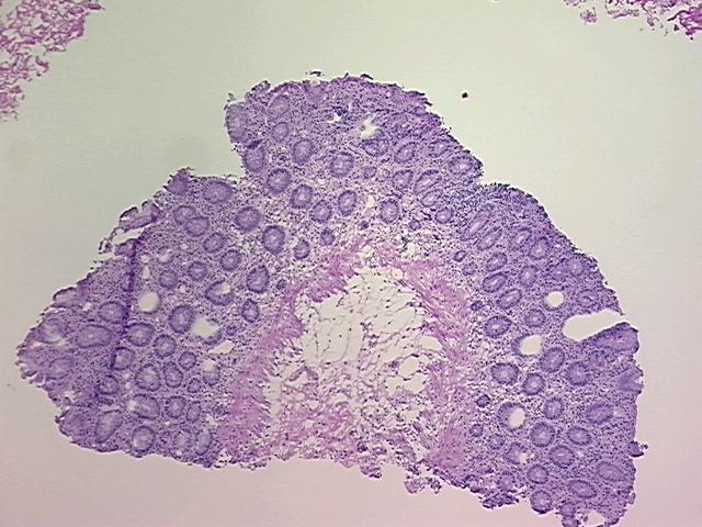 4x Image